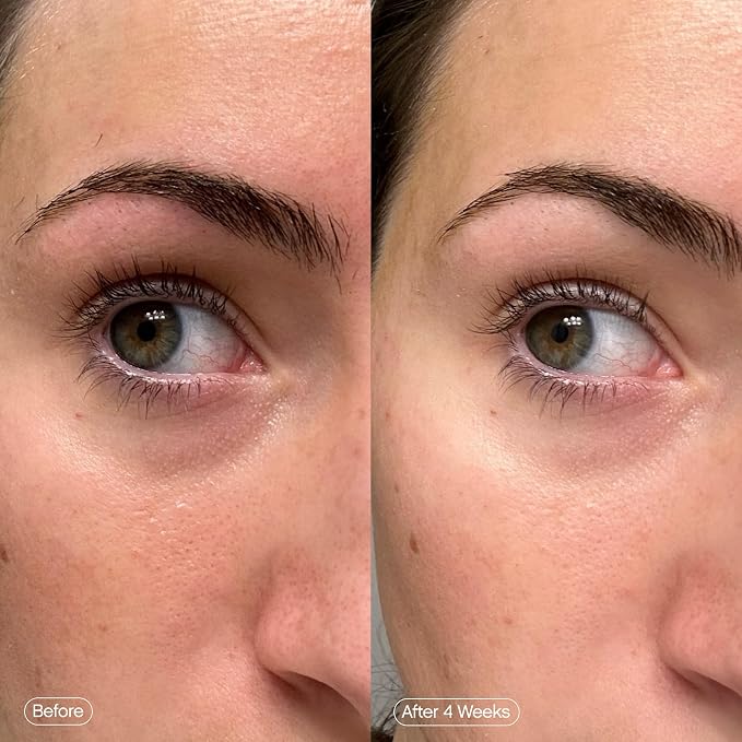Topicals Faded Brightening Under Eye Masks | Patches to Depuff, Brighten and - Image 5