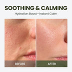 HyCicaMue Green Face Mist | Ultra-Fine Face Spray - Image 3