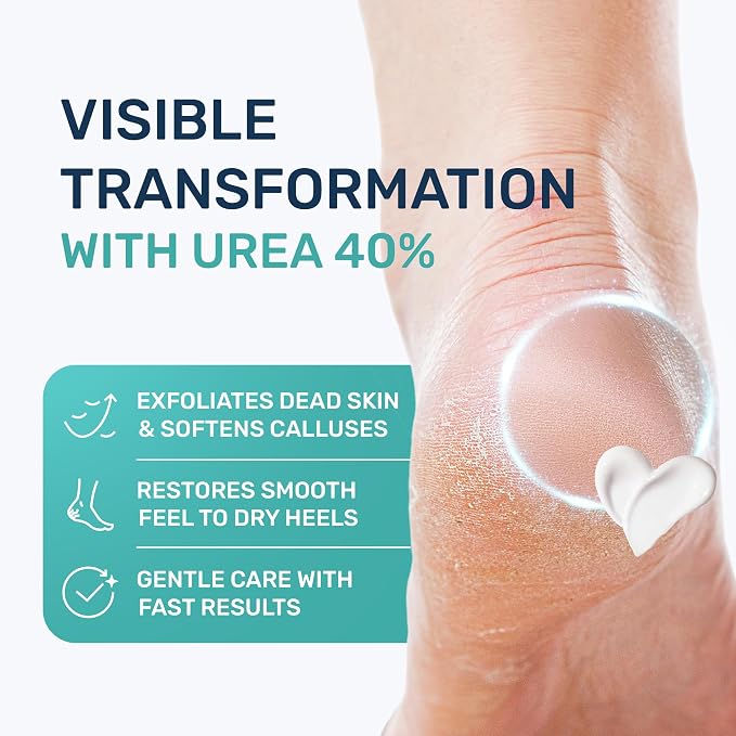Urea Cream 40 Percent for Feet Maximum Strength - Image 2