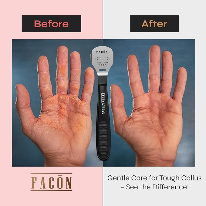 Facón Professional Callus Shaver Remover - Image 4
