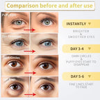 NAZANO 24K Gold Under Eye Patches - Image 3