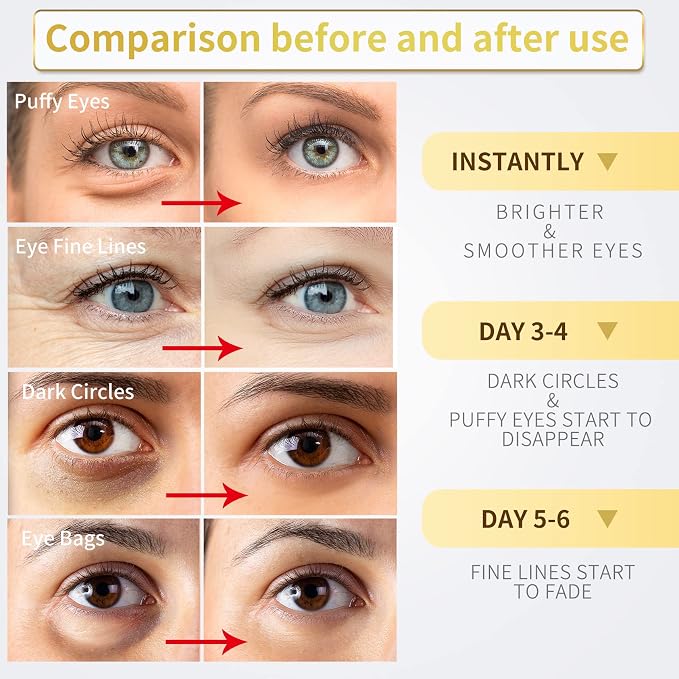 NAZANO 24K Gold Under Eye Patches - Image 3