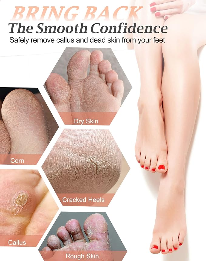 Maryton Natural Pumice Stone for Feet - Image 3
