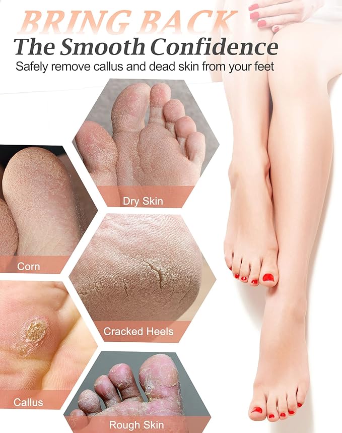 Maryton Natural Pumice Stone for Feet - Image 3