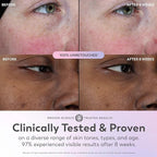Olay Super Serum - Image 6