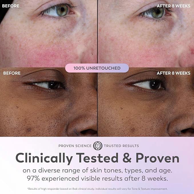 Olay Super Serum - Image 6