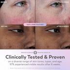 Olay Super Serum - Image 6