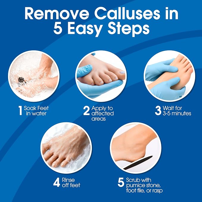 DeEnti Callus Remover for Feet, Extra Strength Foot Callus Remover Gel - Image 4
