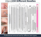22 Pcs Pimple Popper Tool - Image 8