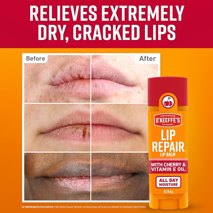 O'Keeffe's Lip Repair Lip Balm - Image 2
