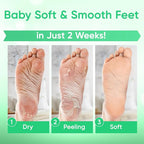 Foot Peel Mask - Foot Mask for Baby Soft Skin - Remove Dead Skin, Cracked Feet - Image 4