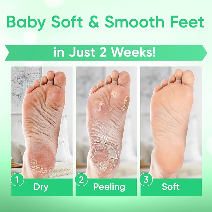 Foot Peel Mask - Foot Mask for Baby Soft Skin - Remove Dead Skin, Cracked Feet - Image 4