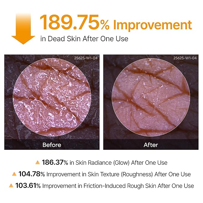 Dr.Melaxin Body Keratin Care Kojic Acid Turmeric Spray - Image 6