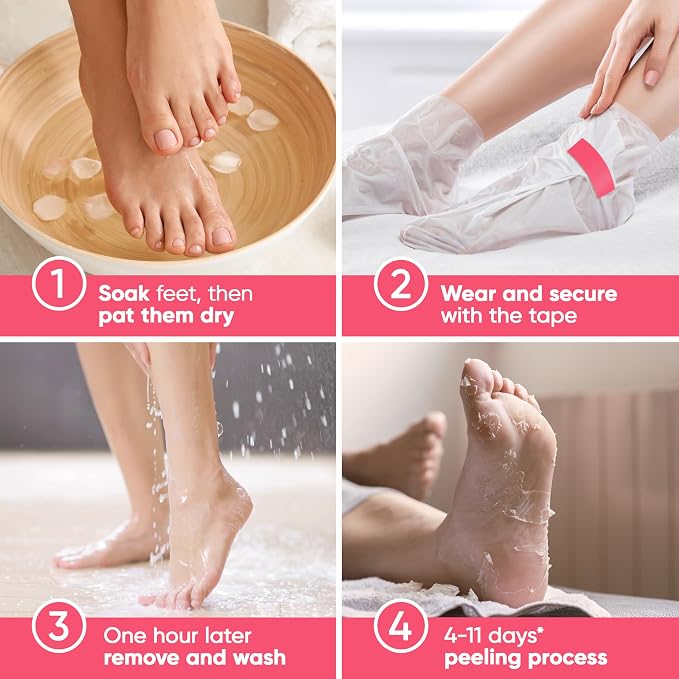 Foot Peel Mask - Foot Mask for Baby Soft Skin - Remove Dead Skin, Cracked Feet - Image 2