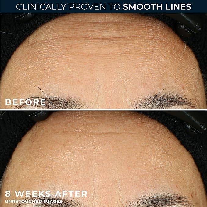 RoC Retinol Correxion Anti-Aging Wrinkle Night Serum, Retinol Serum - Image 4