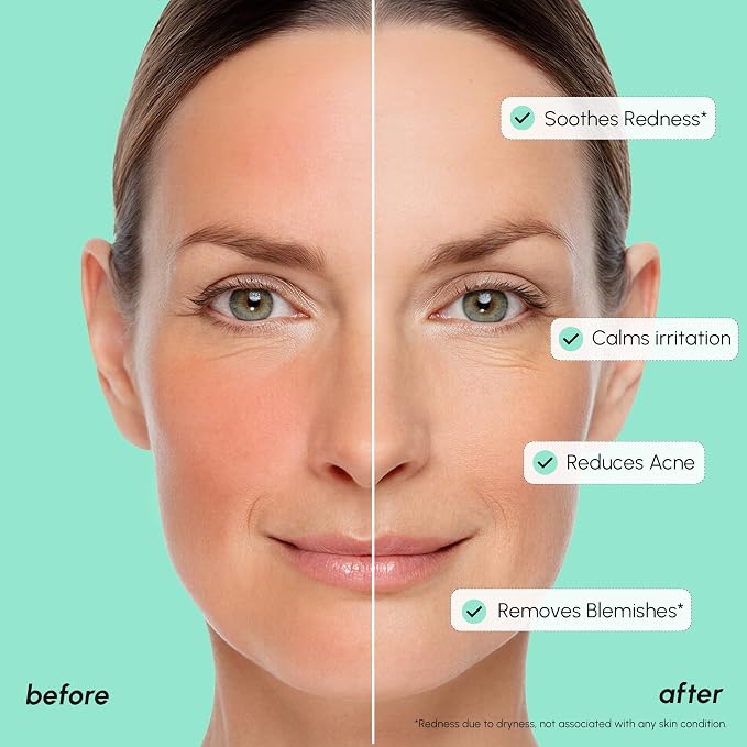 MAREE 10% Azelaic Acid Face Serum - Image 4