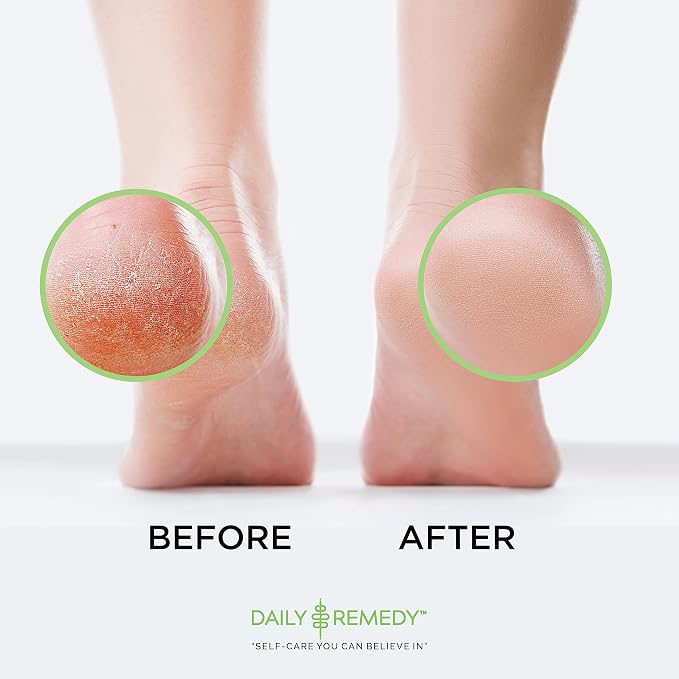 DAILY REMEDY EXTRA STRENGTH Tea Tree Oil Foot Soak w/ Epsom Salt Made in USA - Image 5
