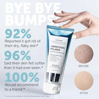 KP Bump Eraser Body Scrub with 10% AHA | Keratosis Pilaris Treatment | Bump - Image 2