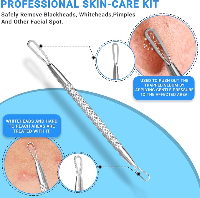 EFAH Care 2Pcs Stainless Steel Pimple Extractor Acne Treatment Tool Surgical - Image 2