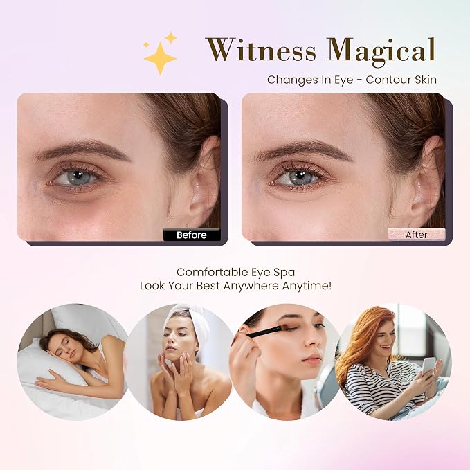 32 Pairs Pink Under Eye Patches, Rose Cooling Hydrating Eye Mask - Image 5