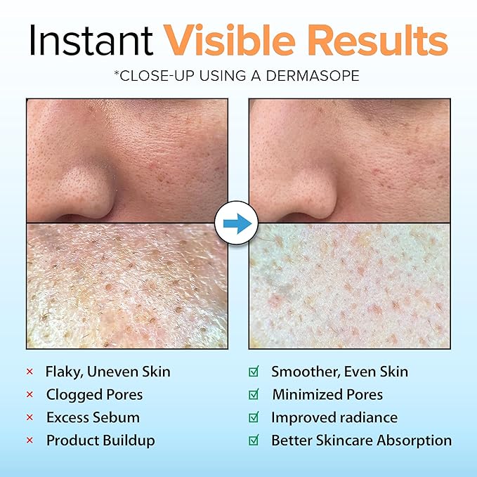 Ebanel 2-Pack Brightening Peeling Gel - Image 3