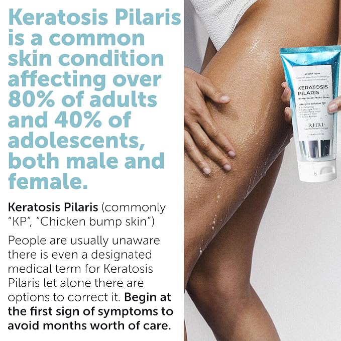 KP Bump Eraser Body Scrub with 10% AHA | Keratosis Pilaris Treatment | Bump - Image 3