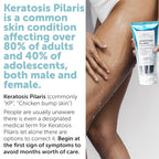 KP Bump Eraser Body Scrub with 10% AHA | Keratosis Pilaris Treatment | Bump - Image 3