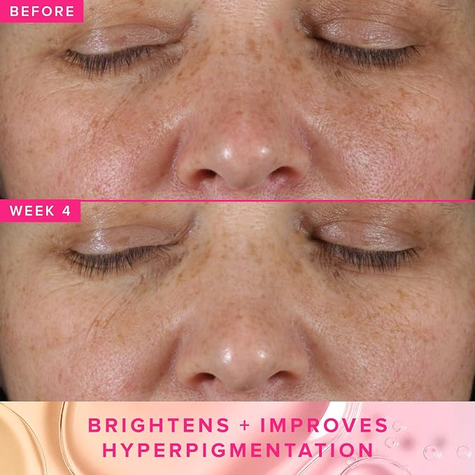 Farmacy 3% TXA Brightening Toner - Image 3