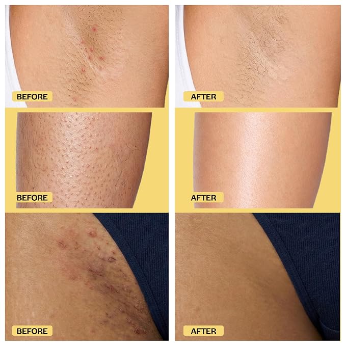 Base Laboratories Ingrown Hair - Image 6