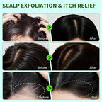Scalp Scrub, Scalp Exfoliator - Image 4