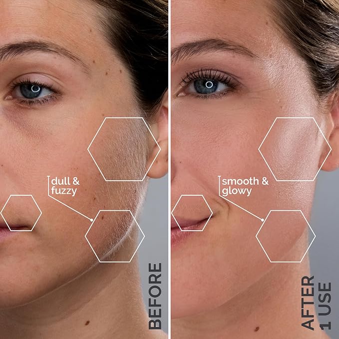 SPA SCIENCES - SIMA Patented Dermaplane Razor - Image 4