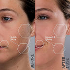 SPA SCIENCES - SIMA Patented Dermaplane Razor - Image 4