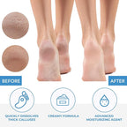 ForPro Professional Collection Premium Callus No More! Callus Remover, - Image 5