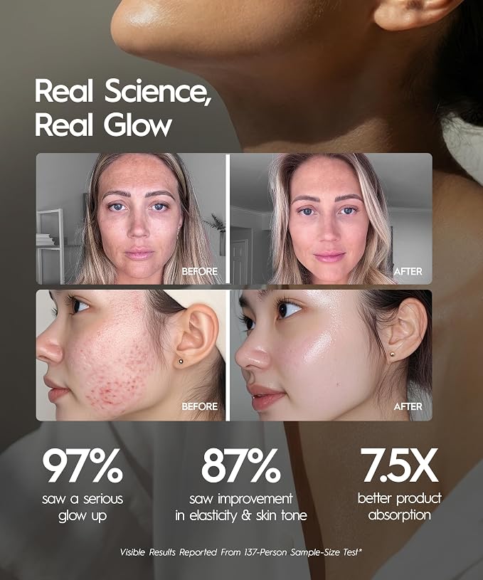 REVO Genie | 3-in-1 Face & Neck Beauty Massager - Image 4