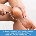 ForPro Professional Collection Premium Callus No More! Callus Remover, - Image 4