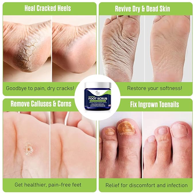 Exfoliating Foot Scrub with Pumice Stone powder - Image 8