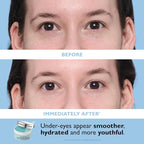 Peter Thomas Roth | Full-Size Vitamin C & Hyaluronic Eye Patches 2-Piece Kit - Image 6