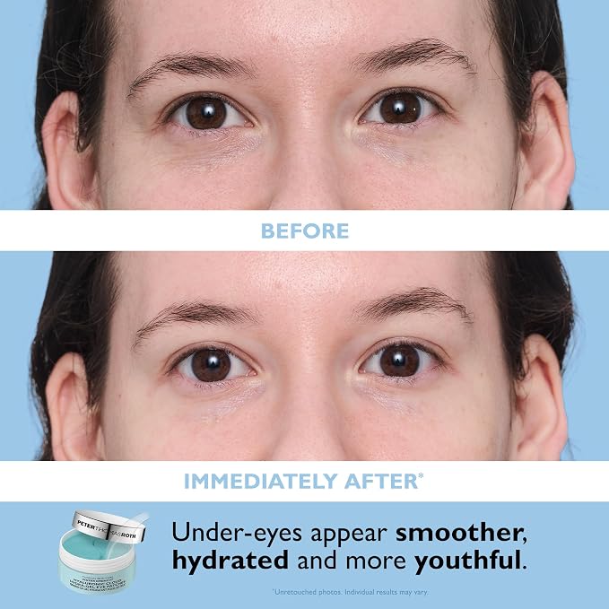Peter Thomas Roth | Full-Size Vitamin C & Hyaluronic Eye Patches 2-Piece Kit - Image 6