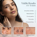 VogueNow LED Light Therapy Mask - Image 3