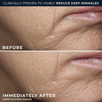 RoC Deep Wrinkle Rich Cream, Fragrance Free, Daily Anti-Aging Firming Cream - Image 4