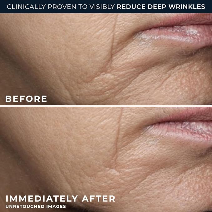 RoC Deep Wrinkle Rich Cream, Fragrance Free, Daily Anti-Aging Firming Cream - Image 4