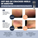 Electric Callus Remover: Rechargeable Electronic Foot File CR900 by Own Harmony - Image 2