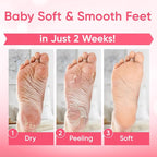 Foot Peel Mask - Foot Mask for Baby Soft Skin - Remove Dead Skin, Cracked Feet - Image 4