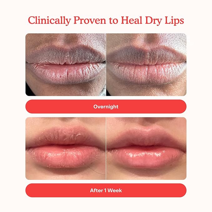 Tower 28 LipSoftie Tinted Lip Balm Treatment - Image 3