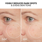 Olay Pro-X Dermatological Even Skin Tone Spot Fading Treatment Serum, 1.3 oz - Image 4
