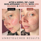Eclat Skincare Rose Water Toner – Hydrating Toner - Image 3