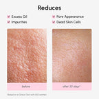 MAREE Pore Minimizer for Face Toner – Witch Hazel Toner - Image 5