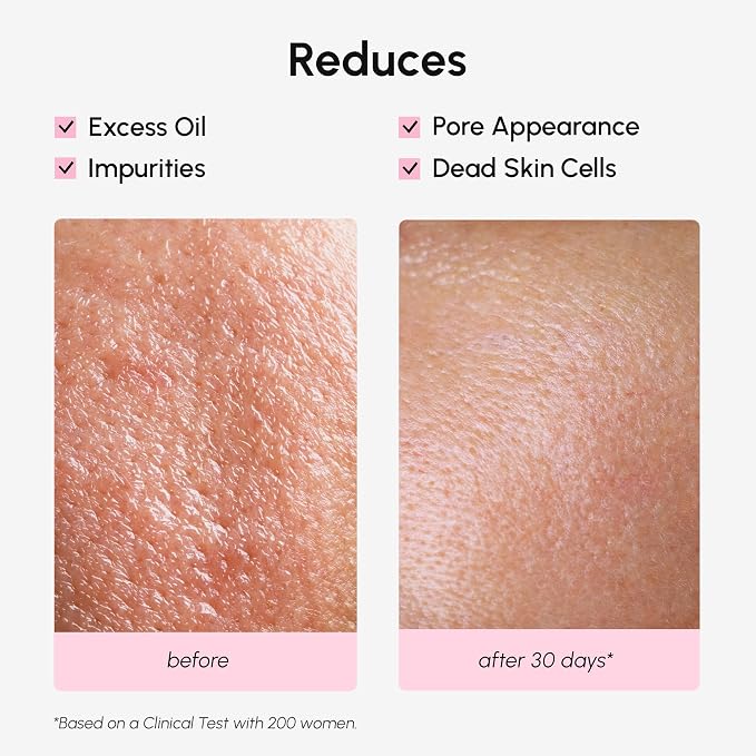 MAREE Pore Minimizer for Face Toner – Witch Hazel Toner - Image 5