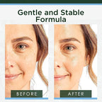 Tree of Life Hyaluronic Acid Serum - Image 3