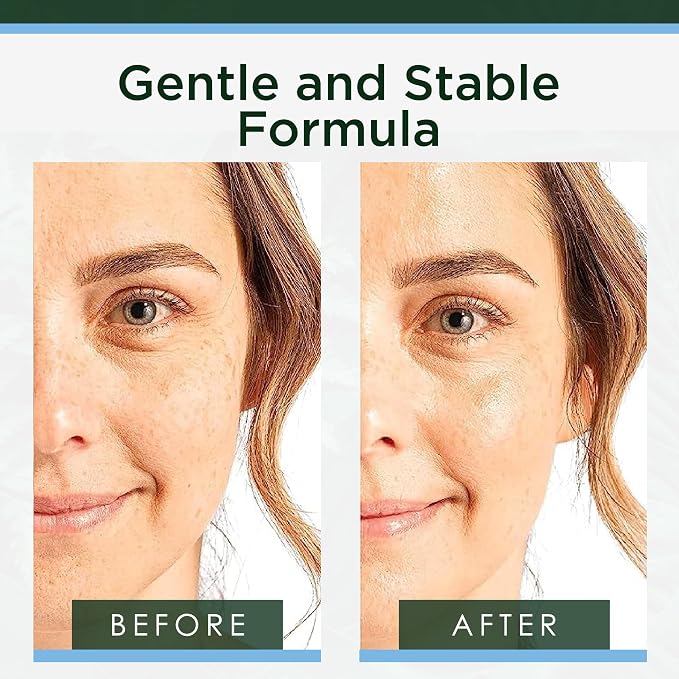 Tree of Life Hyaluronic Acid Serum - Image 3